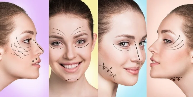 فیس لیفت صورت به روش‌های مختلفی انجام می‌شود