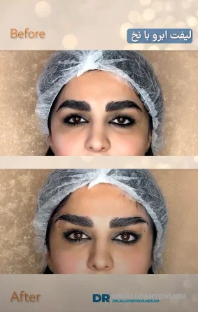 مدل لیفت ابرو پهن