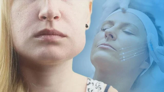 The role of nutrition in the treatment of facial edema after thread lift