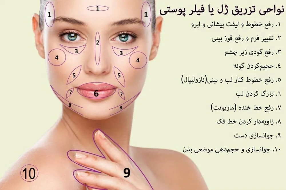 مقایسه برندهای مختلف ژلهای تزریقی