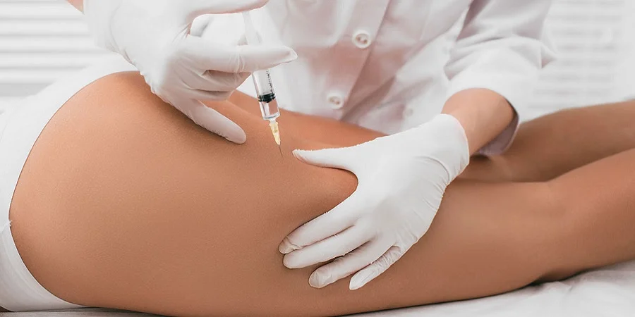 تزریق ژل باسن چگونه انجام می شود؟