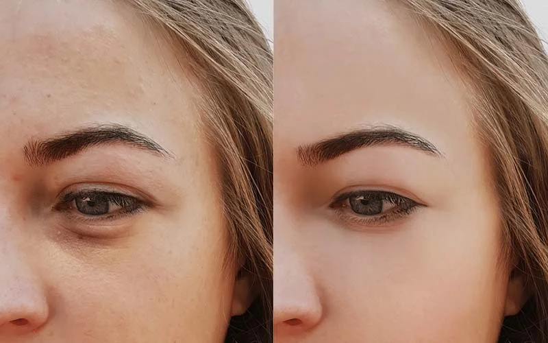 قیمت ژل زیر چشم