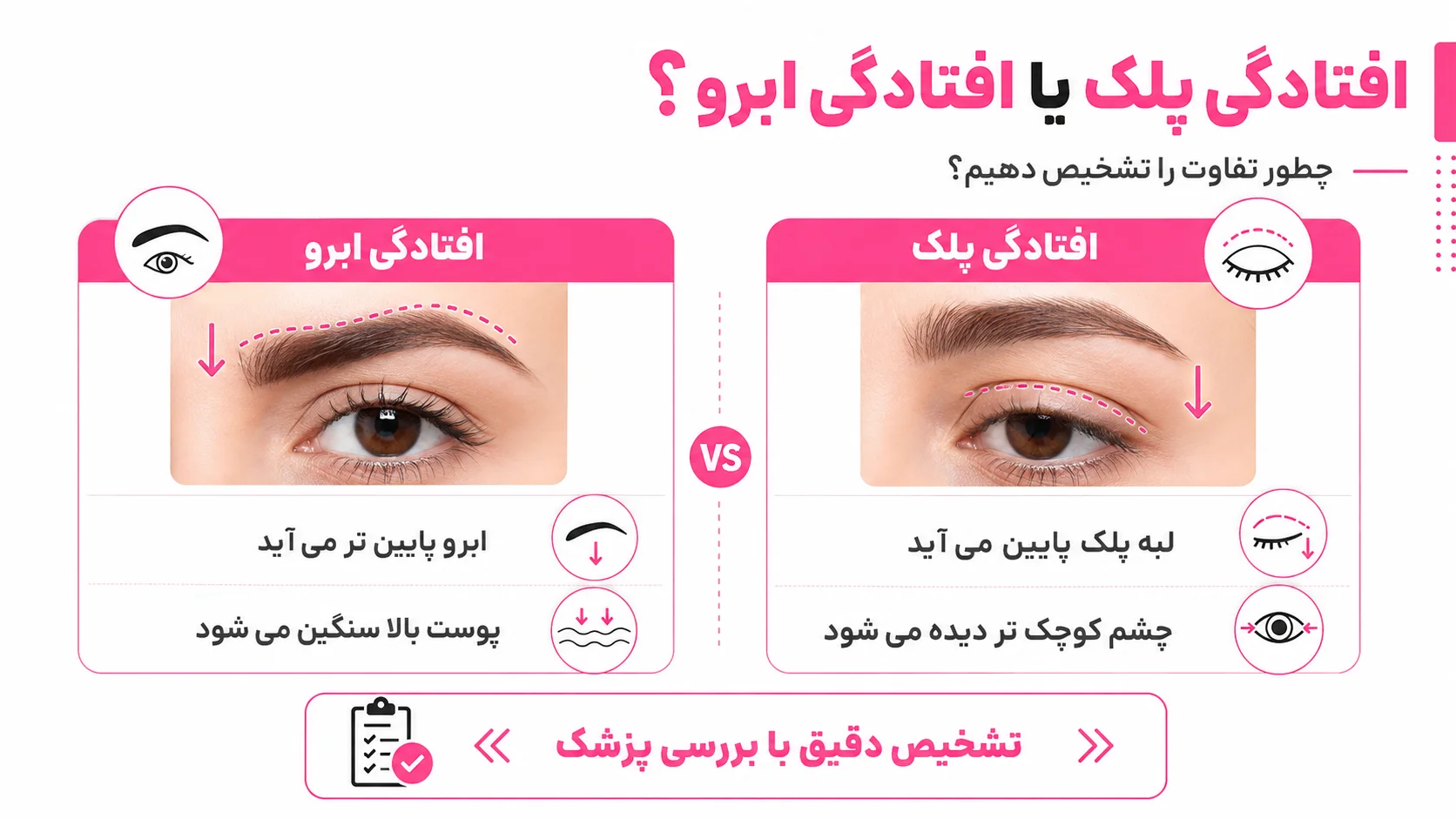 از کجا بفهمیم افتادگی پلک است یا افتادگی ابرو؟