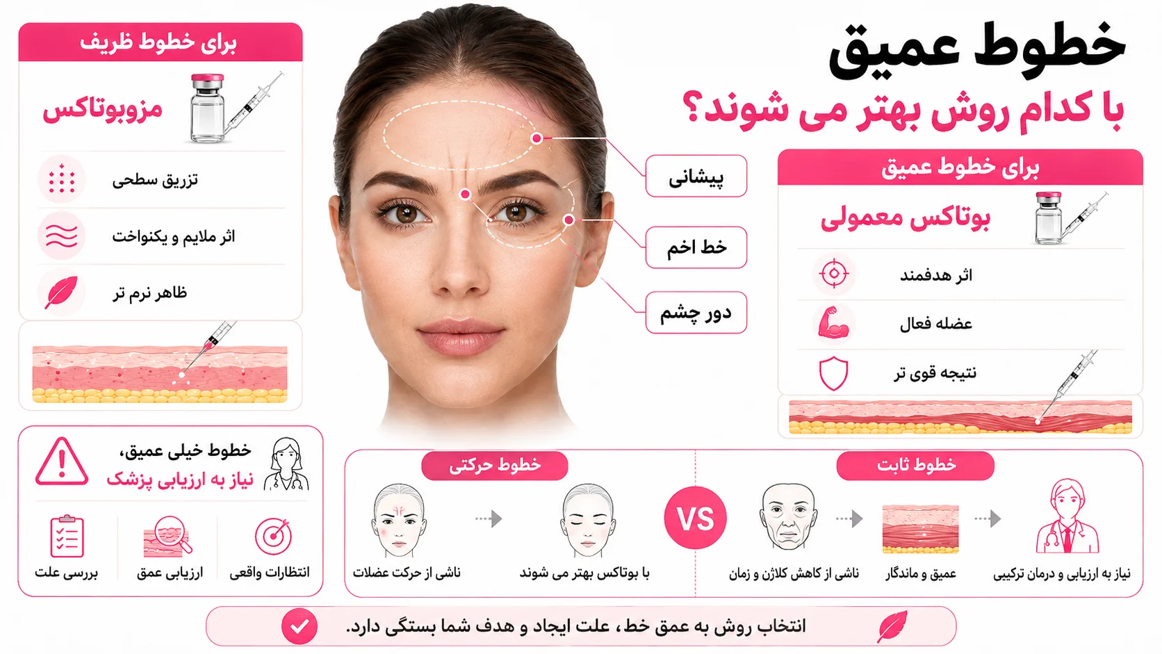 خطوط عمیق با کدام روش بهتر می شوند؟