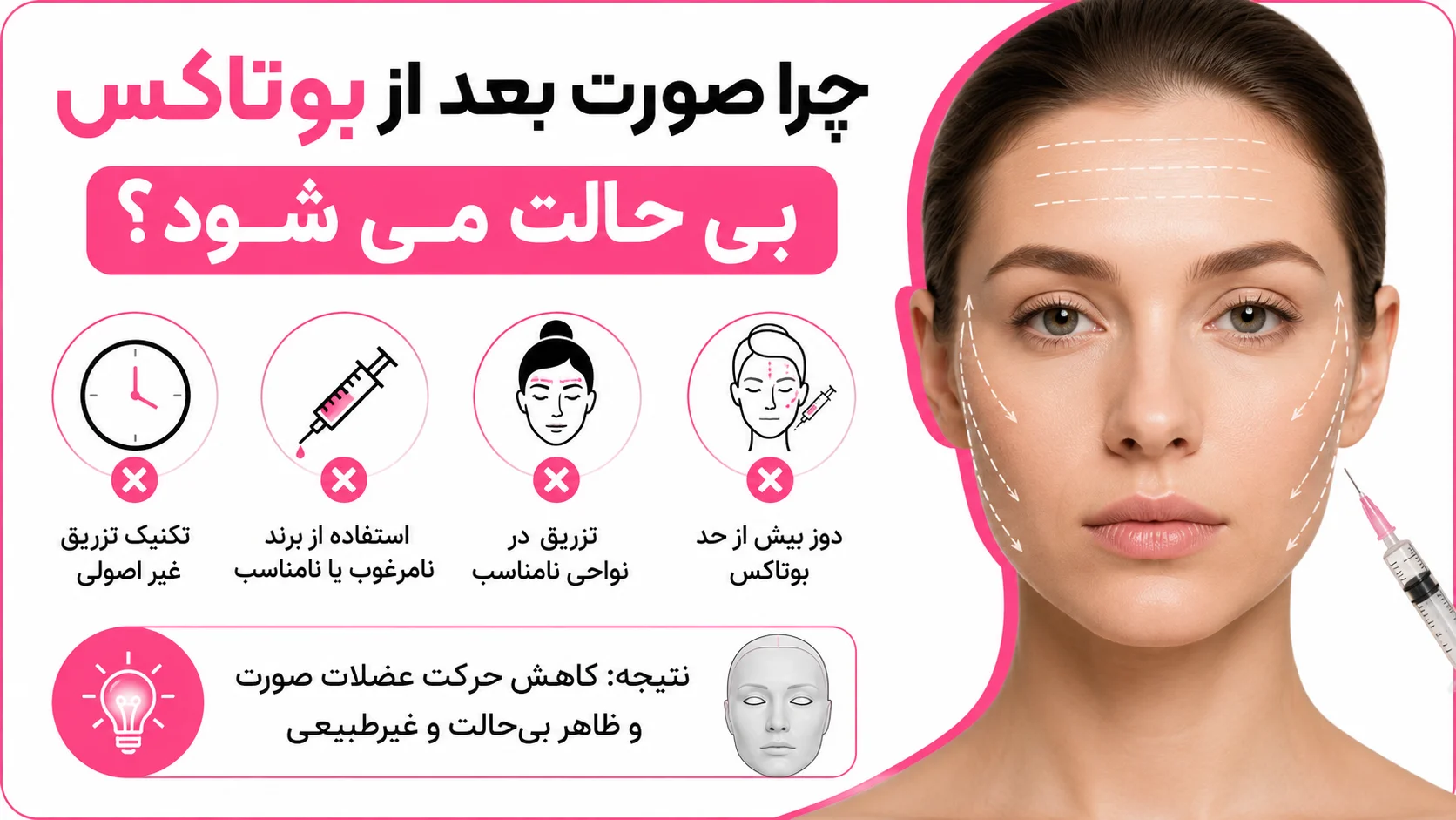 چرا صورت بعد از بوتاکس بی حالت می شود؟
