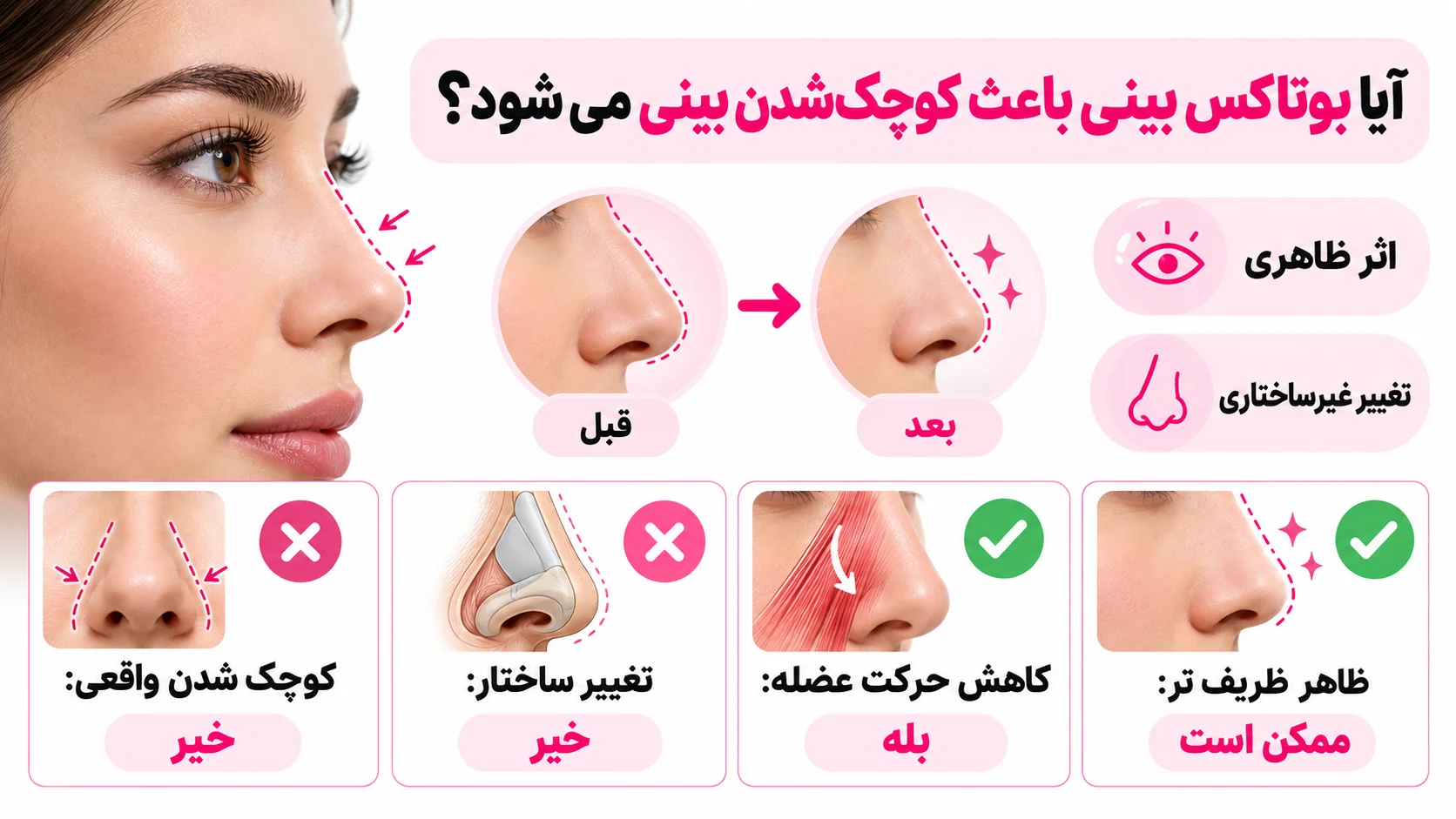 آیا بوتاکس بینی باعث کوچک شدن بینی می شود؟
