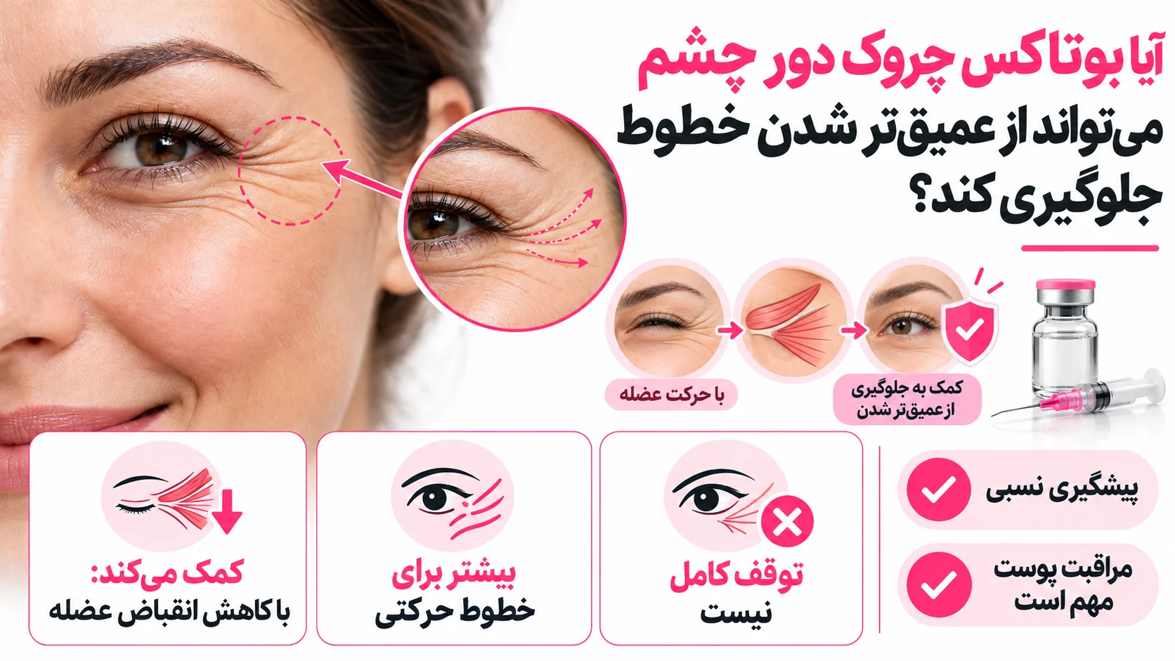 آیا بوتاکس چروک دور چشم می تواند از عمیق تر شدن خطوط جلوگیری کند؟