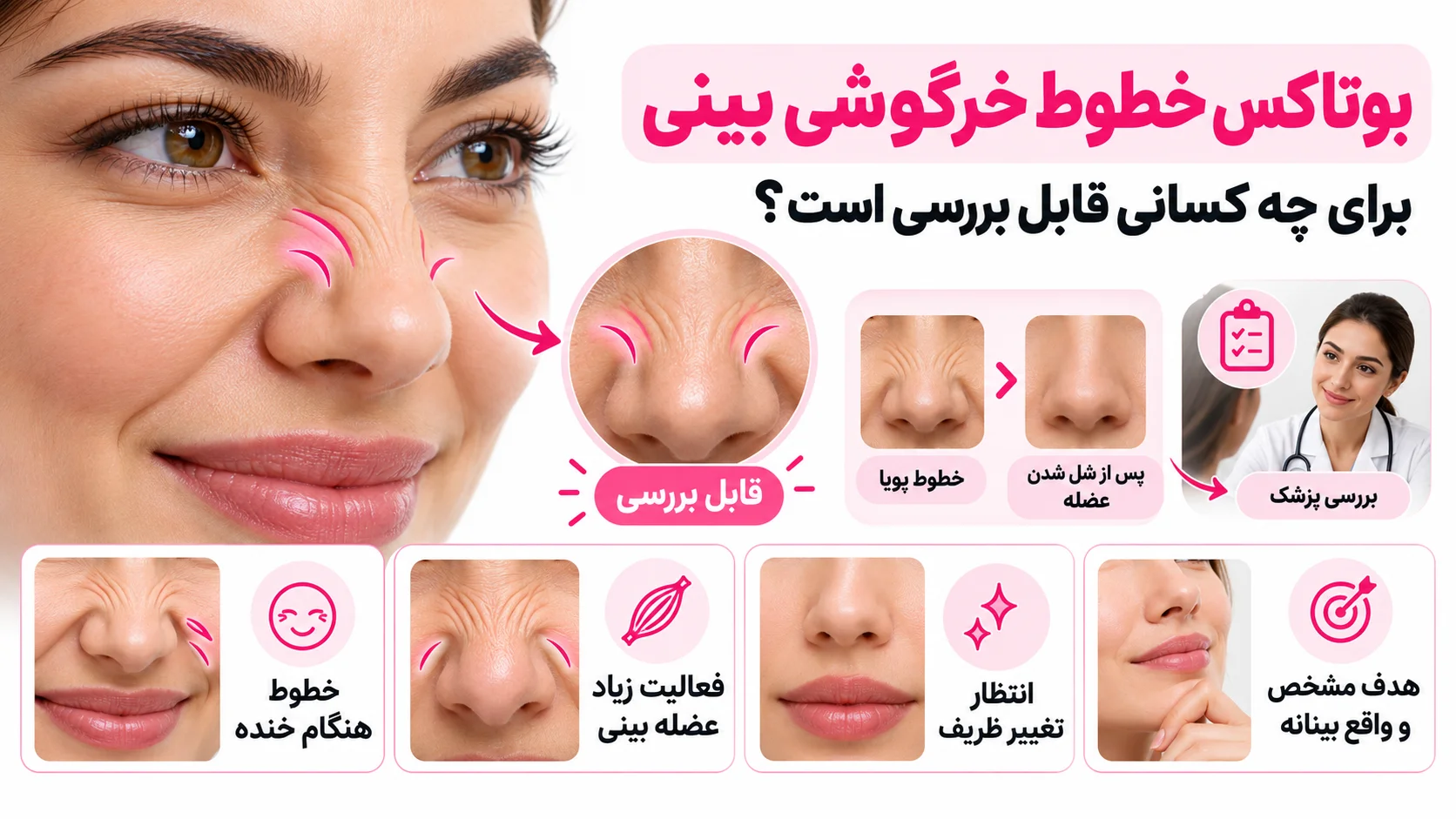 بوتاکس خطوط خرگوشی بینی برای چه کسانی قابل بررسی است؟
