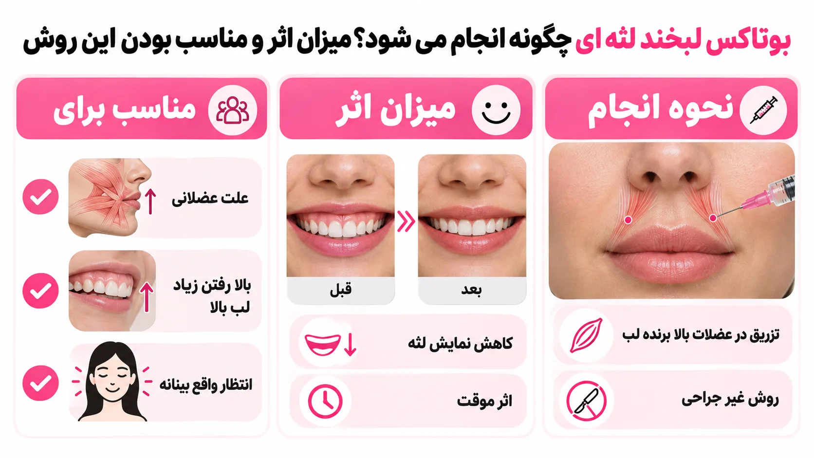 بوتاکس لبخند لثه ای چگونه انجام می شود؟ میزان اثر و مناسب بودن این روش
