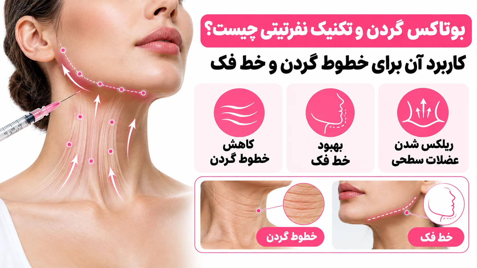 بوتاکس گردن و تکنیک نفرتیتی چیست؟ کاربرد آن برای خطوط گردن و خط فک
