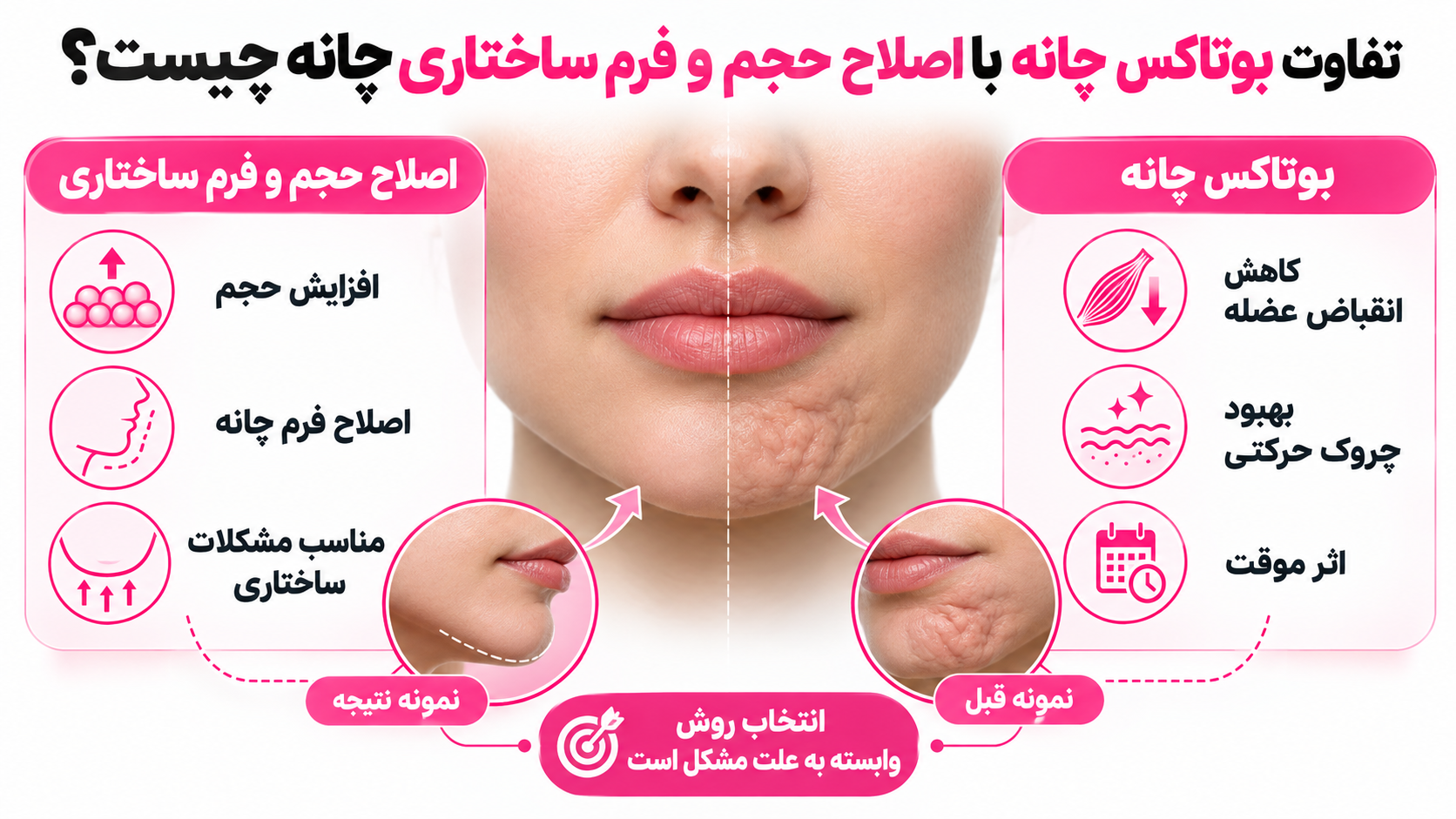 تفاوت بوتاکس چانه با اصلاح حجم و فرم ساختاری چانه چیست؟