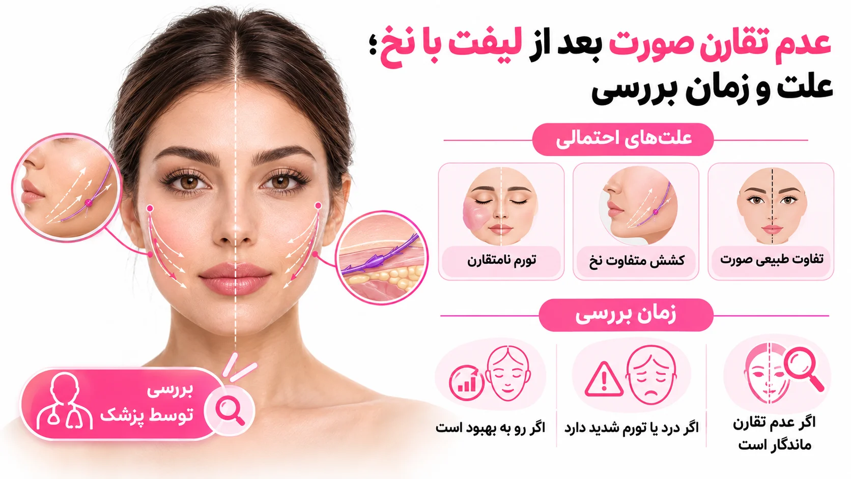 عدم تقارن صورت بعد از لیفت با نخ؛ علت و زمان بررسی