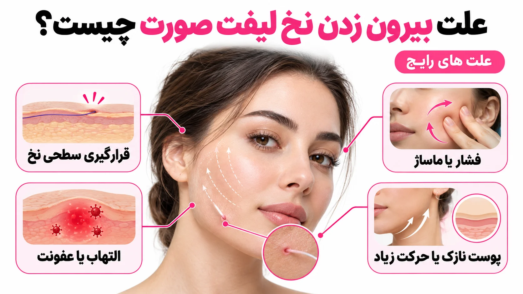 علت بیرون زدن نخ لیفت صورت چیست؟