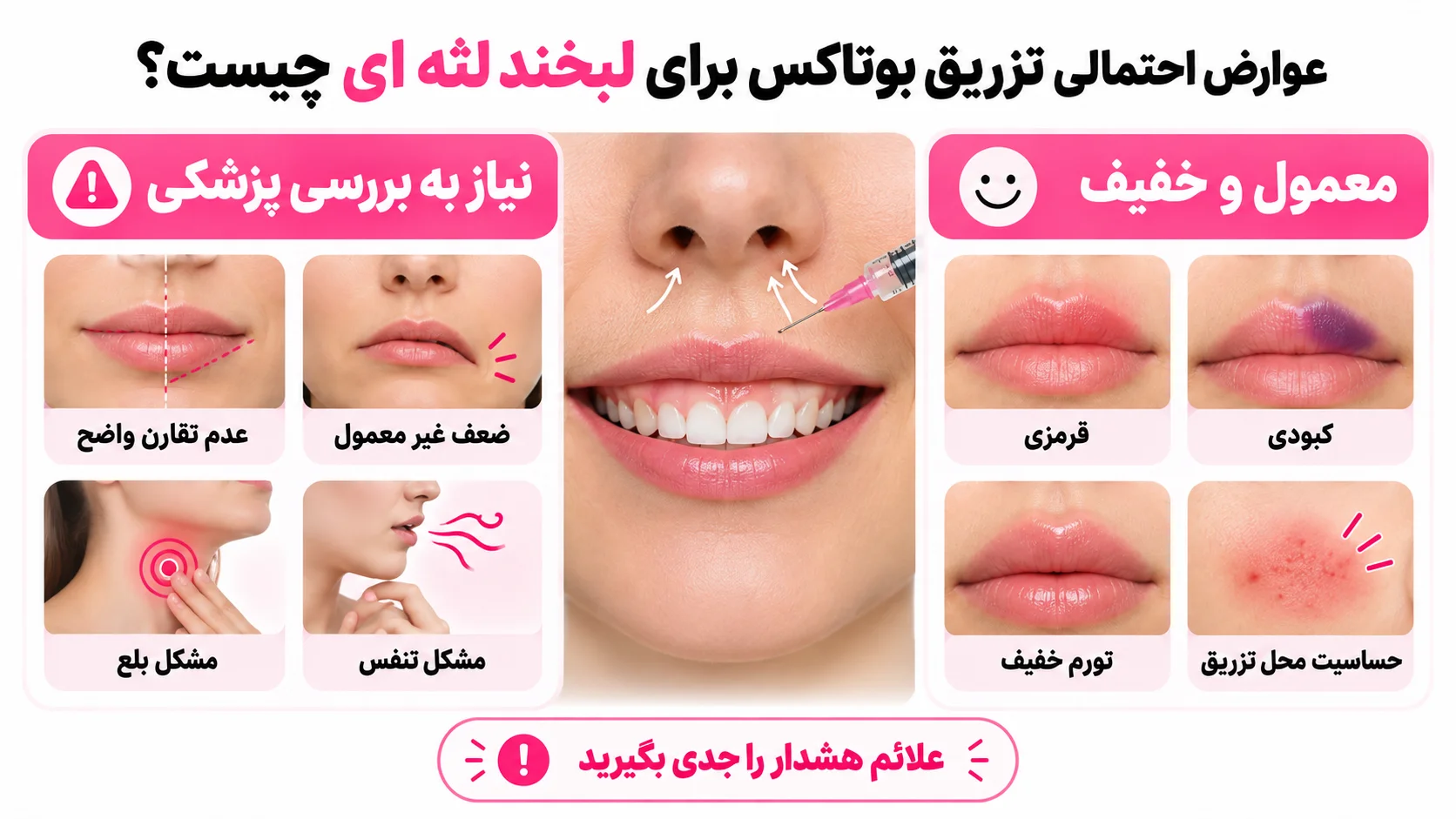 عوارض احتمالی تزریق بوتاکس برای لبخند لثه ای چیست؟