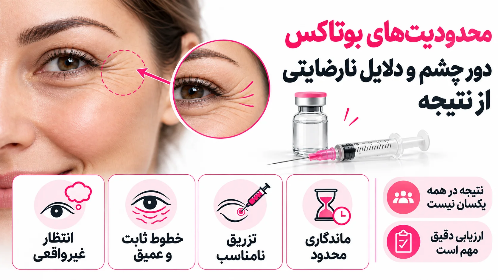 محدودیت های بوتاکس دور چشم و دلایل نارضایتی از نتیجه