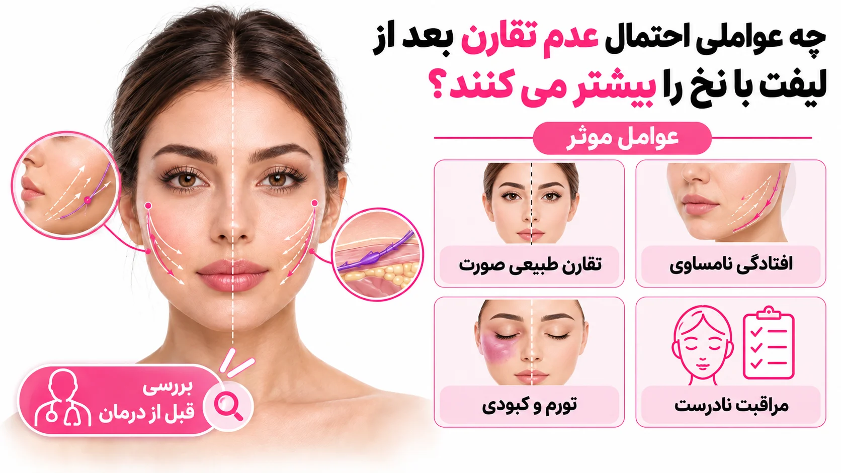 چه عواملی احتمال عدم تقارن بعد از لیفت با نخ را بیشتر می کنند؟